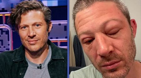 Zach Gilford Shares His SHOCKING Swollen Face After Medical Emergency