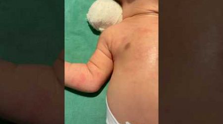 Whole Body Redness #medical #newbornbaby #viralvideo