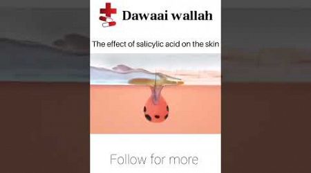 Salicylic acid #youtubeshorts #youtube #medicine #pharmacy #viralshort