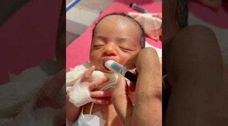 Syringe Feeding #medical #newbornbaby #viralvideo