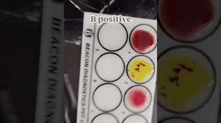 BLOOD GROUP PRACTICAL