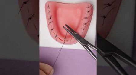 Stitching Gums 