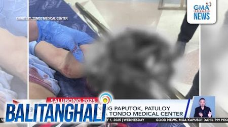 Mga nasabugan ng paputok, patuloy na dumarating sa Tondo Medical Center | Balitanghali