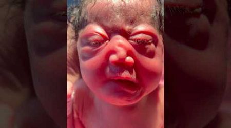 His Cute Crying at Birth #medical #viralvideo