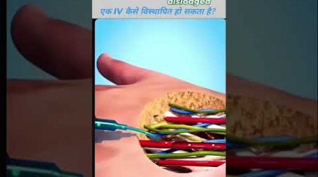 Medical student by Rohit Kumar #medical #shortvideo #doctor #medicaleducation #injection #blood