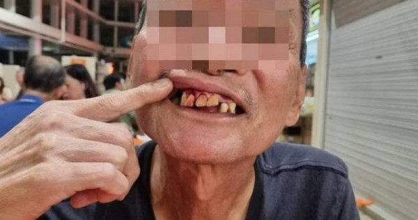 Too little meat in 'cai fan'? Angry customer leaves Bedok hawker bleeding after slamming his head against wall