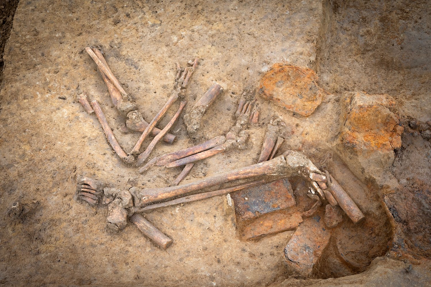 Disturbing Pile of Amputated Limbs Uncovered at Battle of Waterloo Site